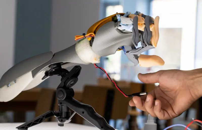 bionic arm